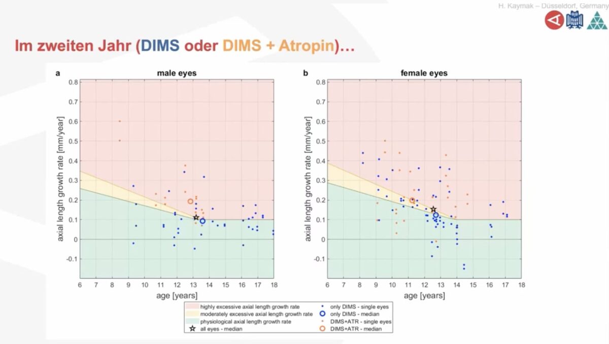 Die Ergebnisse nach zwei Jahren mit DIMS- und DIMS plus Atropin.