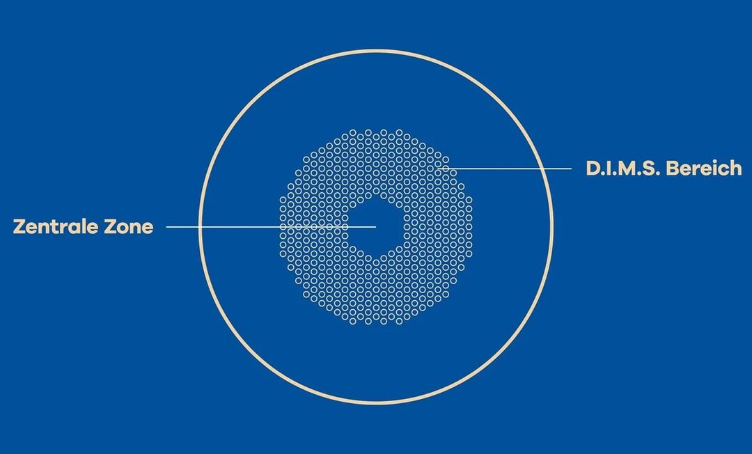 Grafische Darstellung der Optik des Miyosmart Brillenglases mit DIMS Bereich.