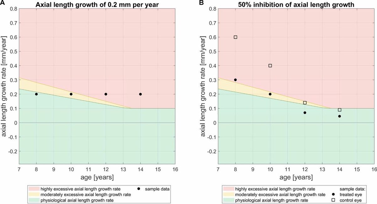 Darstellung von zwei Charts des AMMC-Konzteptes. Mithilfe dieses Konzepte können die gemessenen Werte der Achslänge direkt mit dem physiologischen Wachstum altersgleicher Kinder verglichen werden.