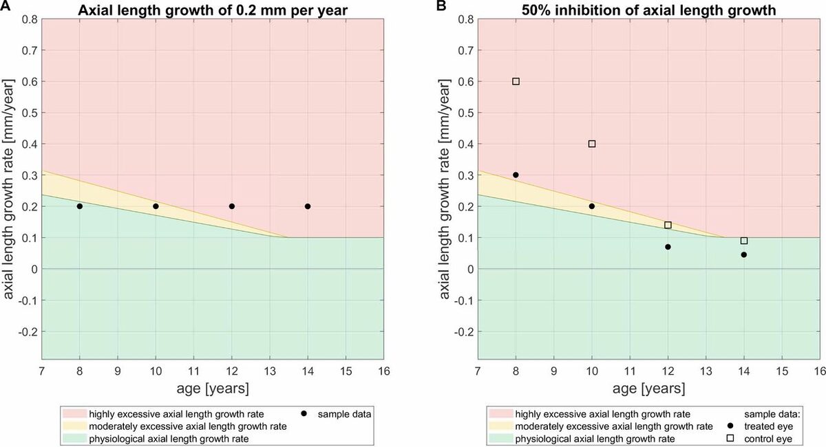 Darstellung von zwei Charts des AMMC-Konzteptes. Mithilfe dieses Konzepte können die gemessenen Werte der Achslänge direkt mit dem physiologischen Wachstum altersgleicher Kinder verglichen werden.